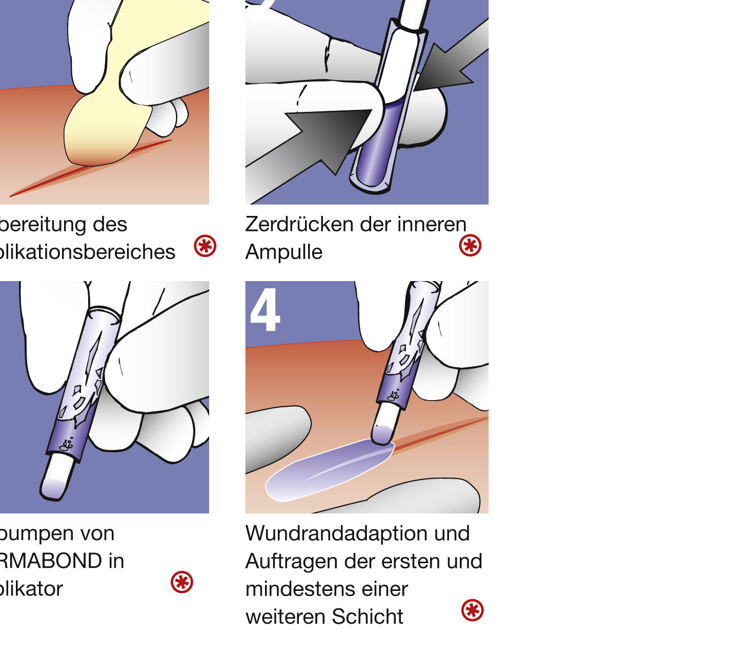 Dermabond Anwendung Alles, was Sie über die Verwendung und Vorteile