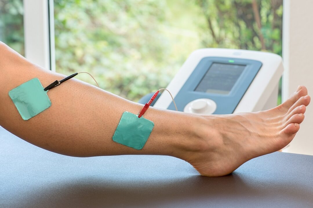 Effektive Anwendung von TENS-Geräten: Alles, was Sie wissen müssen