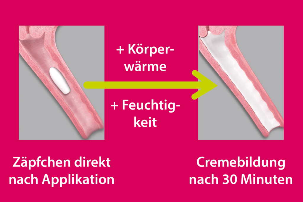 Vagisan Milchsäure Zäpfchen: Anwendung, Wirkung und Tipps für die